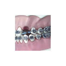 LEONE MOLLE MEMORIA A SPIRALE APERTE